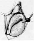 app. testis